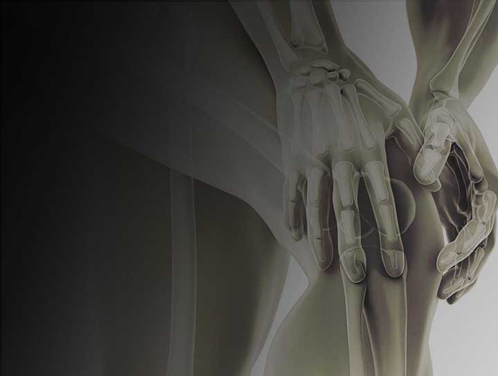 Bones & Joints