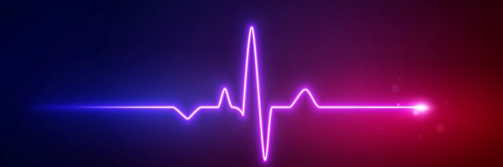 ECG graphic
