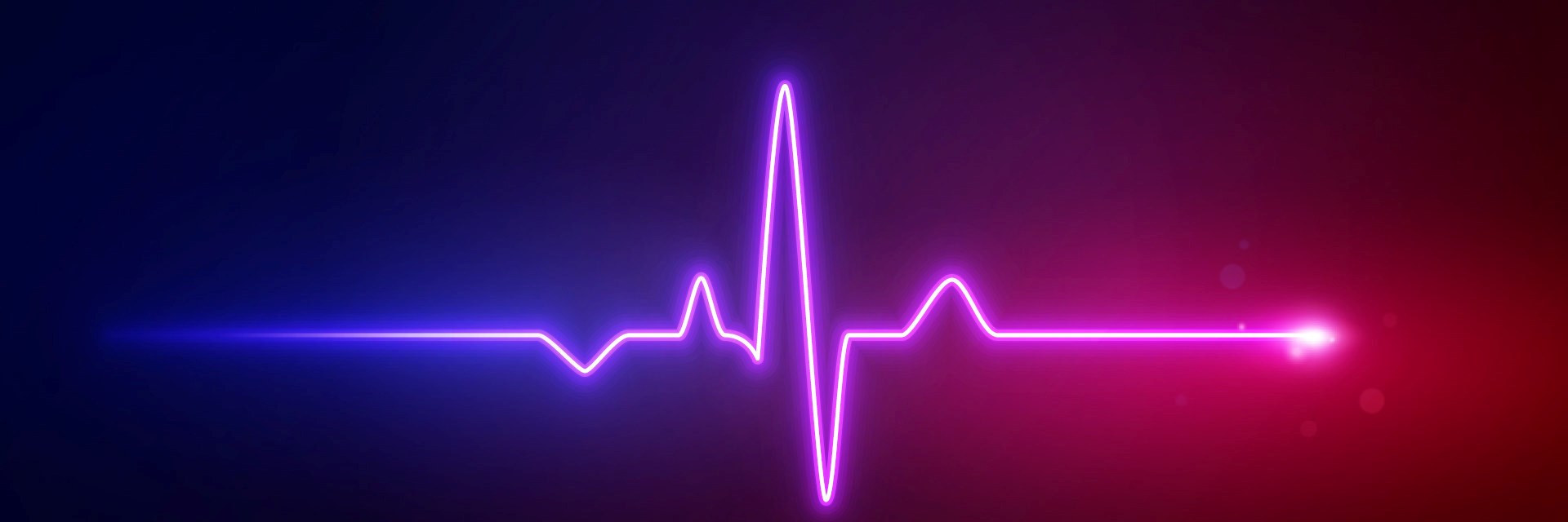 ECG graphic